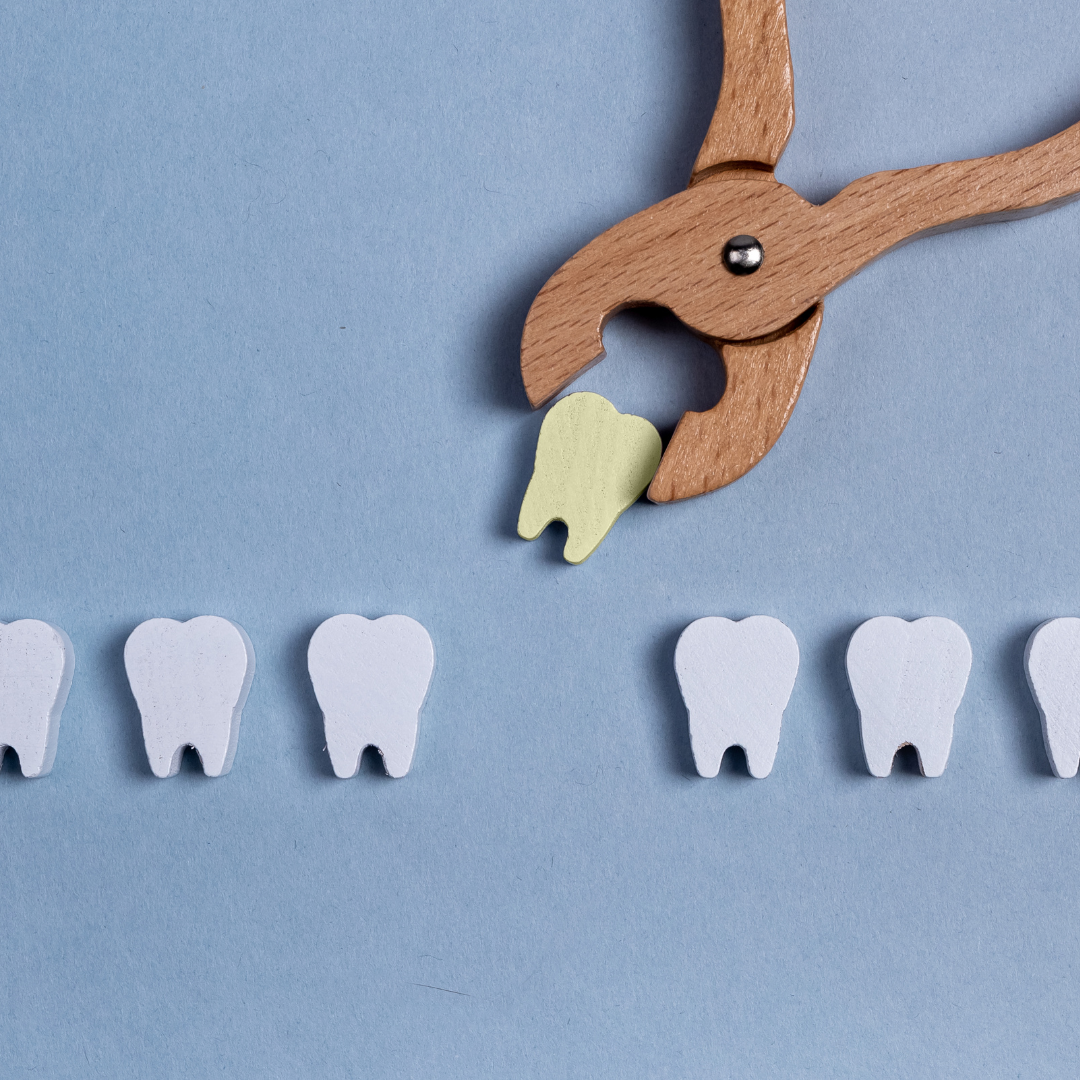 A Closer Look at Wisdom Teeth Extraction: Comprehensive Insights by Crown Dental Inglewood