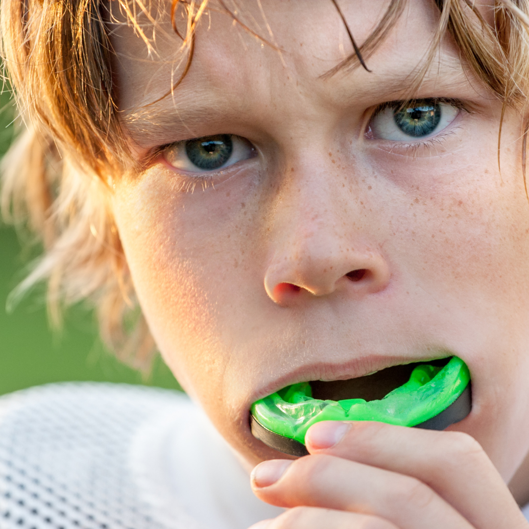 Protecting Your Smile with Mouthguards