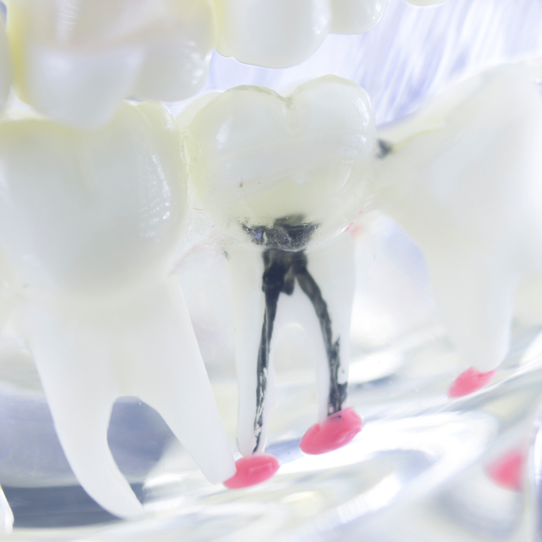 The Intricacies of Root Canals: Dispelling Myths and Embracing Facts