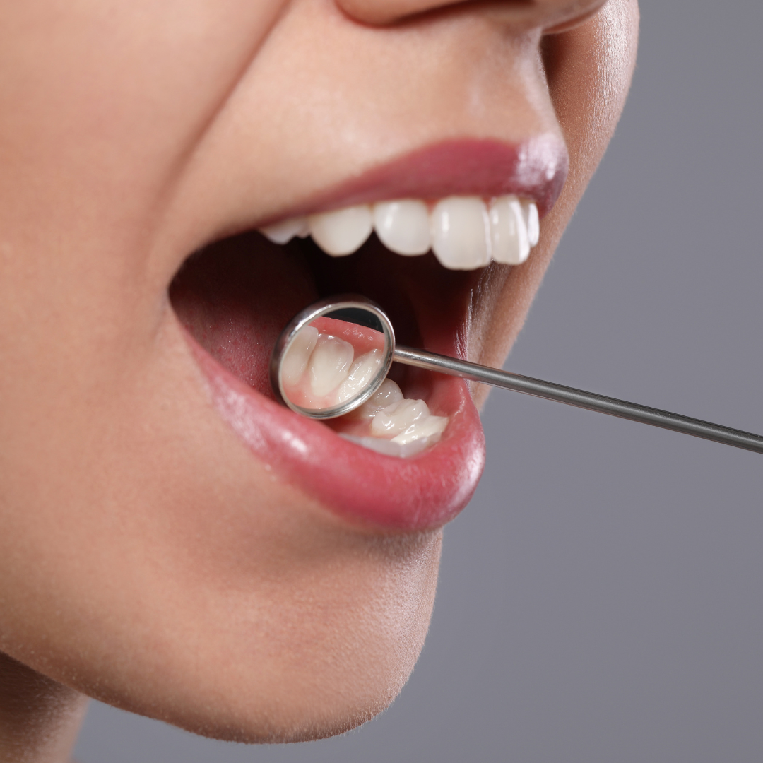 Understanding the Importance of Oral Cancer Screenings